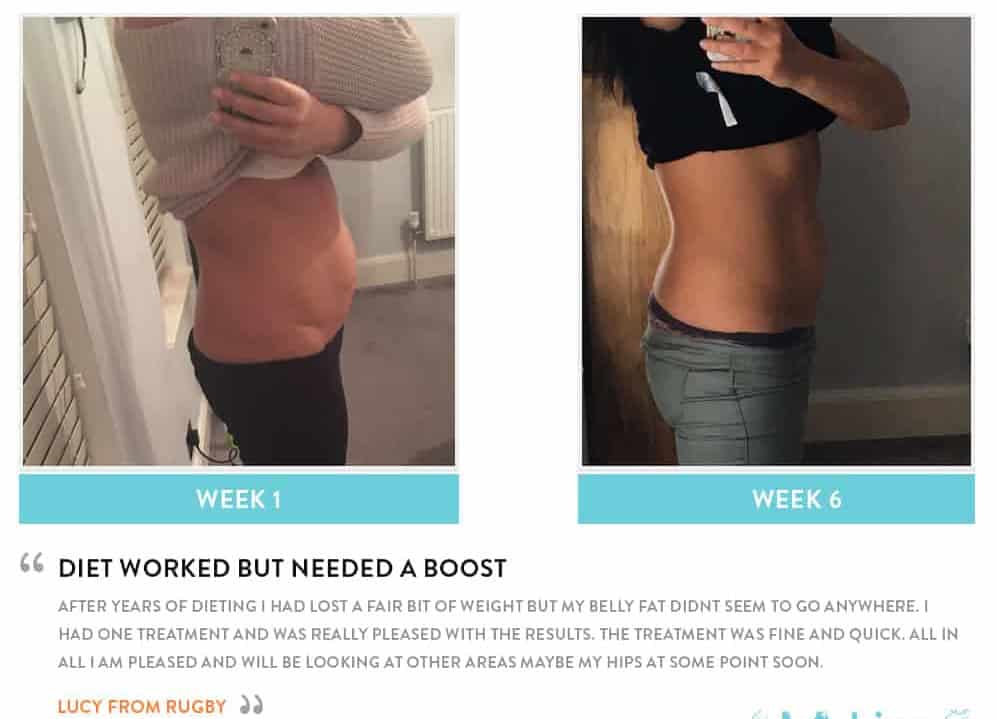 Before and After Dieting Chiswick