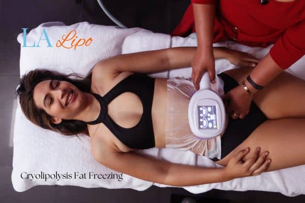 woman getting cryolipolysis Chiswick
