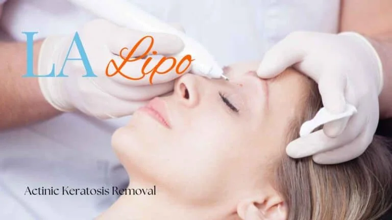 Woman receiving Actinic Keratosis Removal Treatment Chiswick