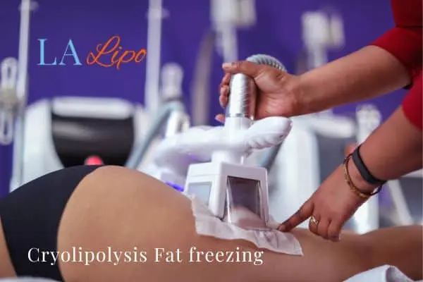 women getting fat freezing Chiswick