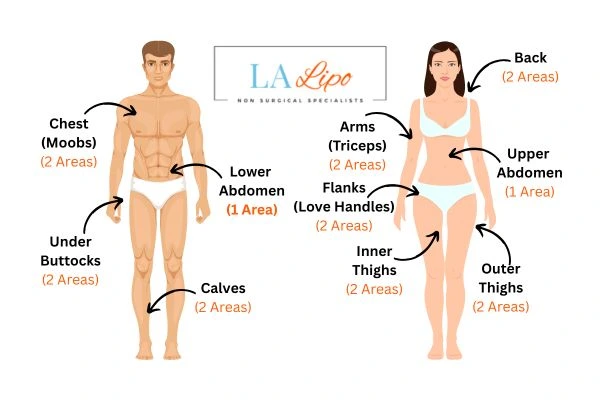 LA LIPO Cryolipolysis Areas Chiswick