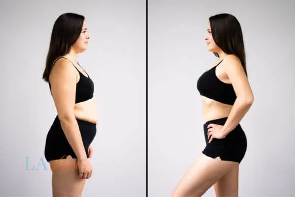 link between body image and mental health Chiswick