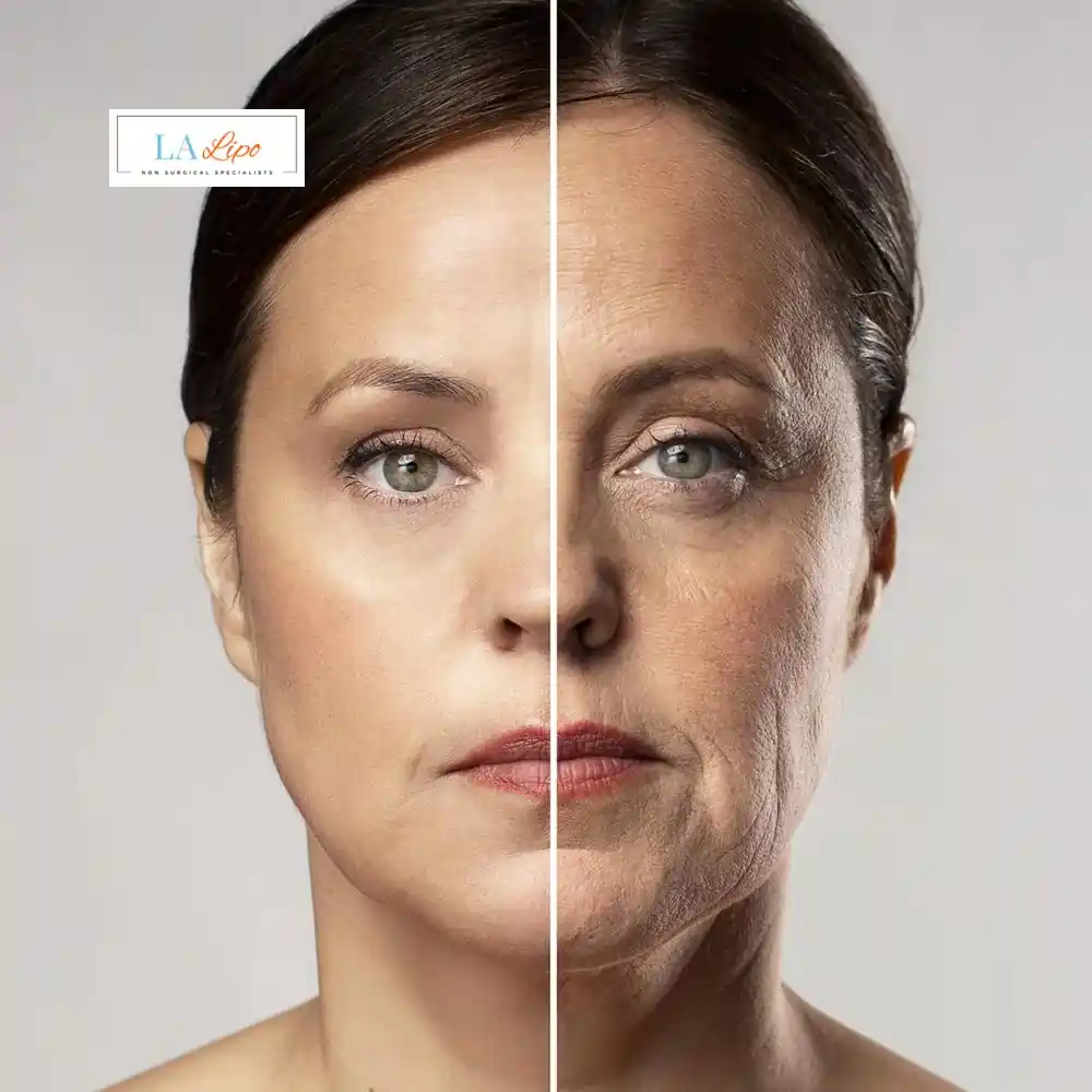 How Can You Tell If Non-Surgical Skin Tightening Is Right for You Chiswick?