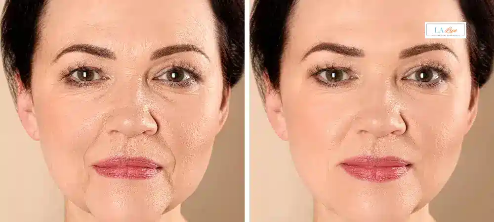 How Long Does It Take to See Results and How Long Do They Last Chiswick?