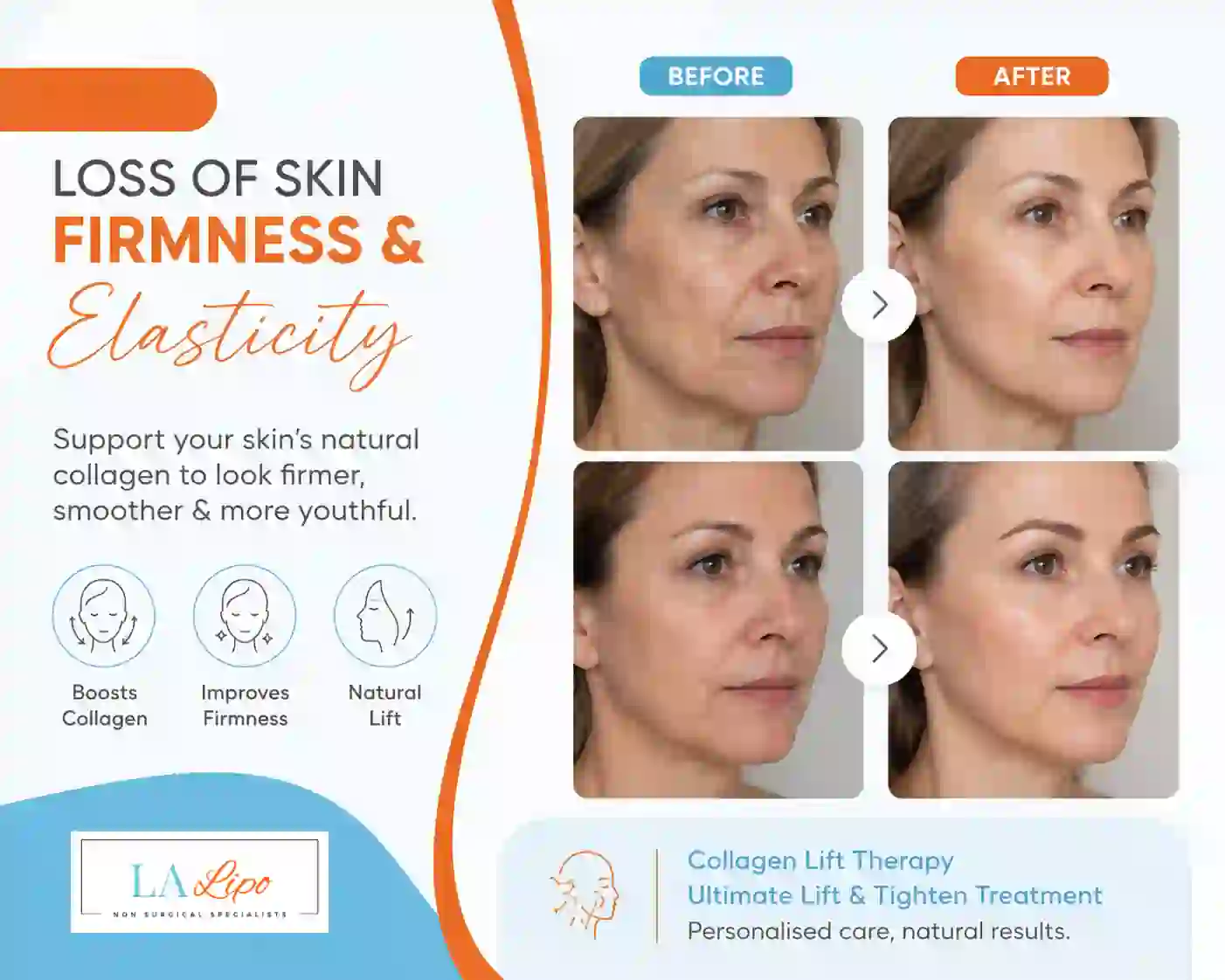 Sign #7: Loss of Skin Firmness and Elasticity Chiswick
